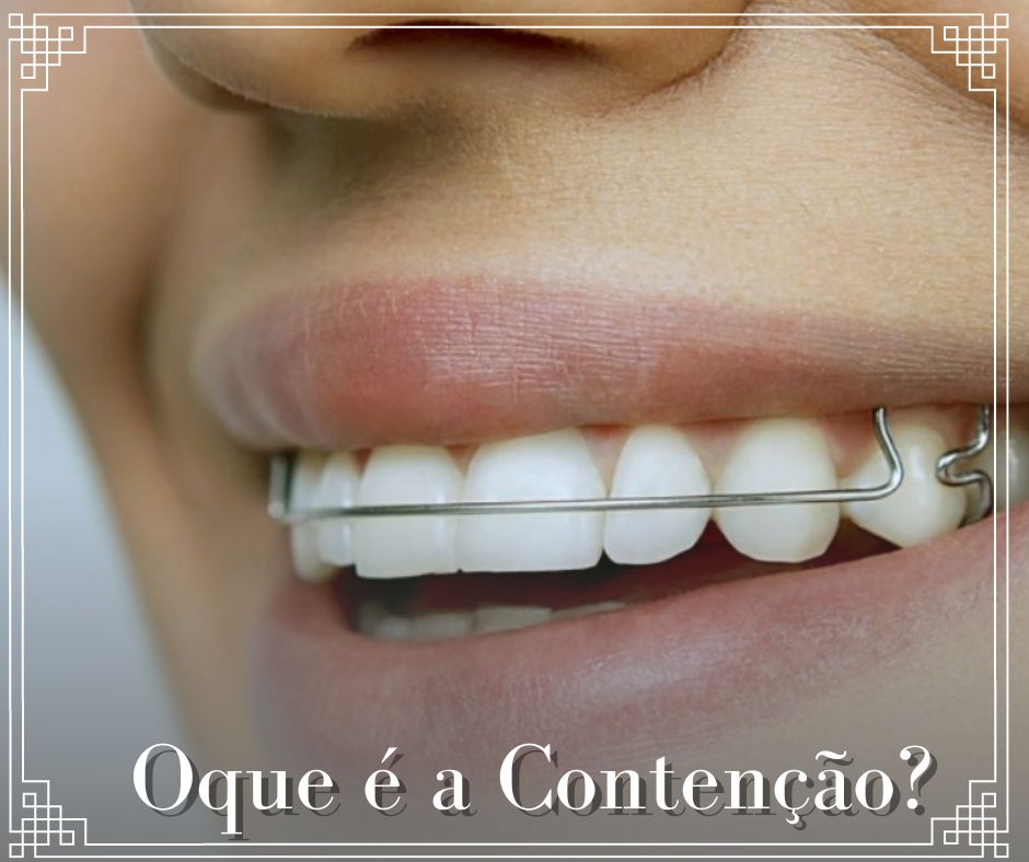 Conten o Flex vel Para Dentes Moles RETOEDU