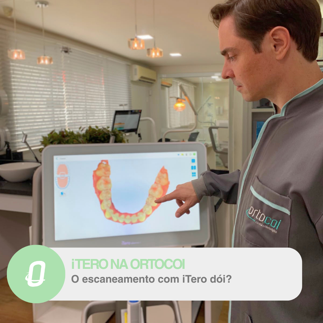 O escaneamento com iTero dói ou incomoda? Descubra como funciona essa tecnologia
