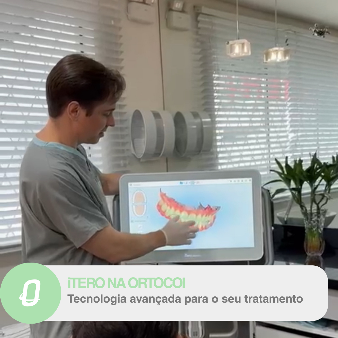 Escaneamento com iTero em Jaraguá do Sul: Conforto e tecnologia avançada na Ortocoi clínica odontológica