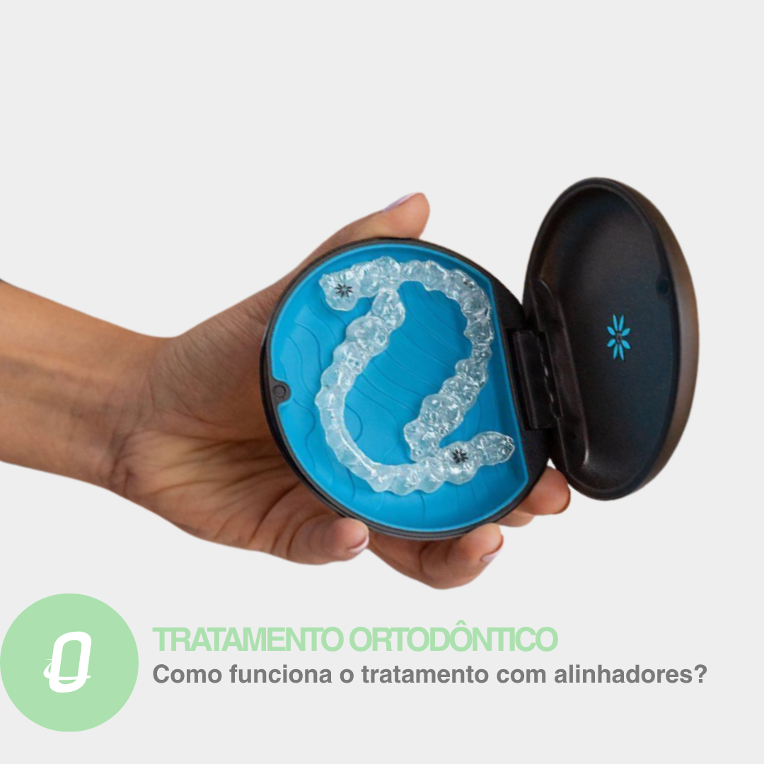 Invisalign em Jaraguá do Sul: como funciona o tratamento com alinhadores transparentes